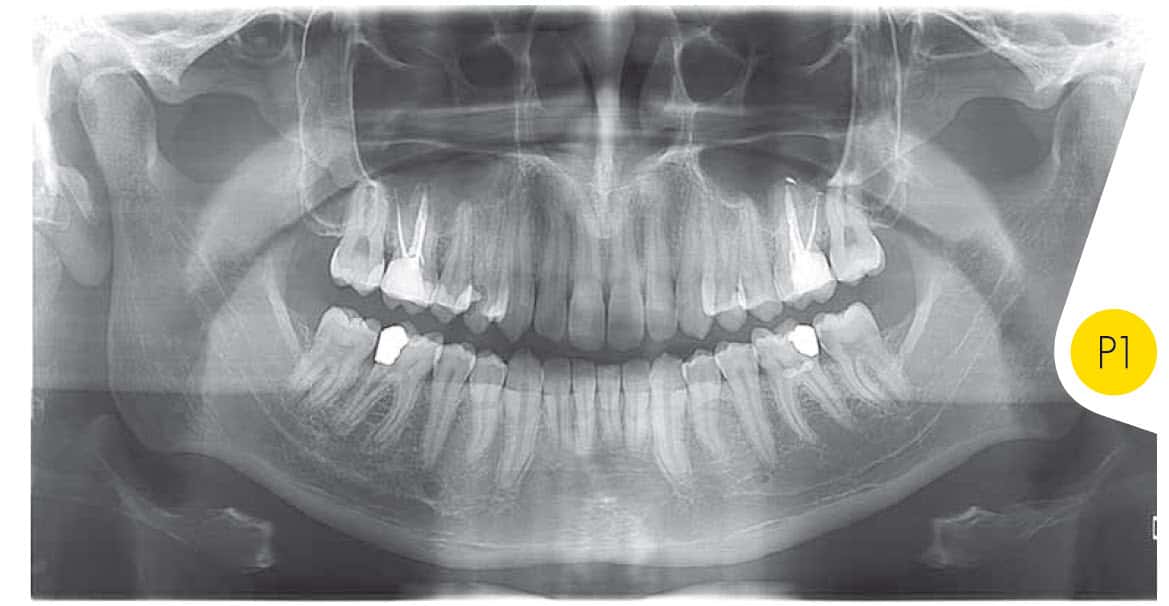 dental-ct-scan-panoramic.jpg