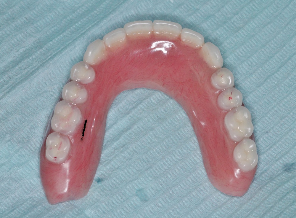 <h3>Teeth View of Denture</h3>