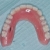 Teeth View of Denture
