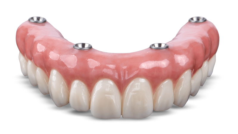 Full Zircova Bridge All on Four dental implant cost